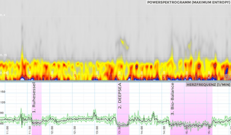 Herzrate und "fire of life"-Darstellung mit der Software cardiscope der Fa. Hasiba während der Entspannungsphasen (VP4). Foto: Source Gesundheitsberatung